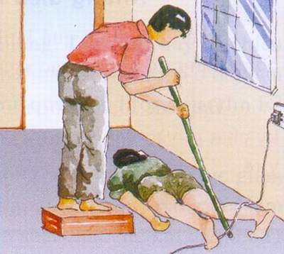 Cách cấp cứu người bị bỏng điện 